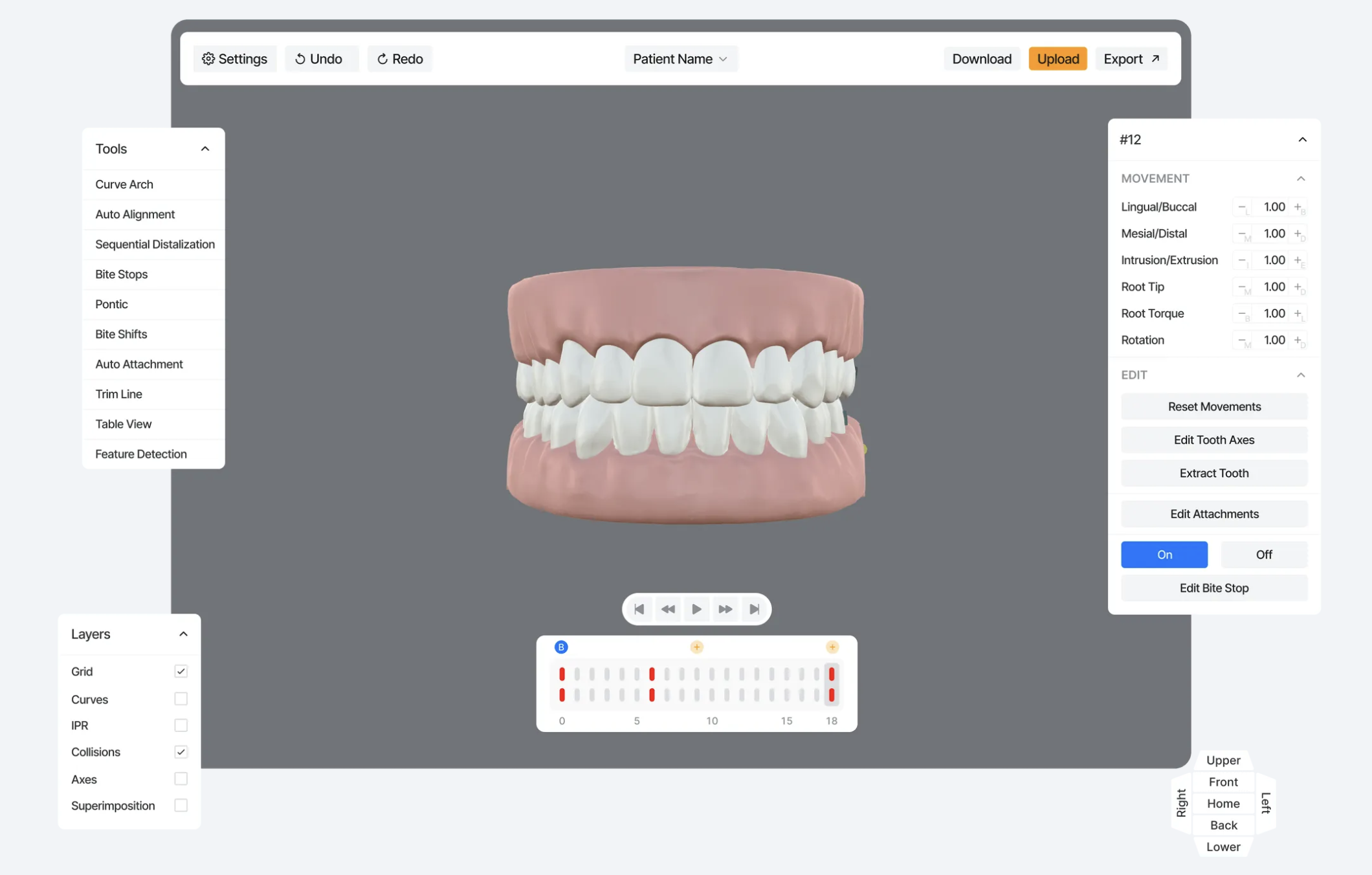 Clear Aligner Design Software